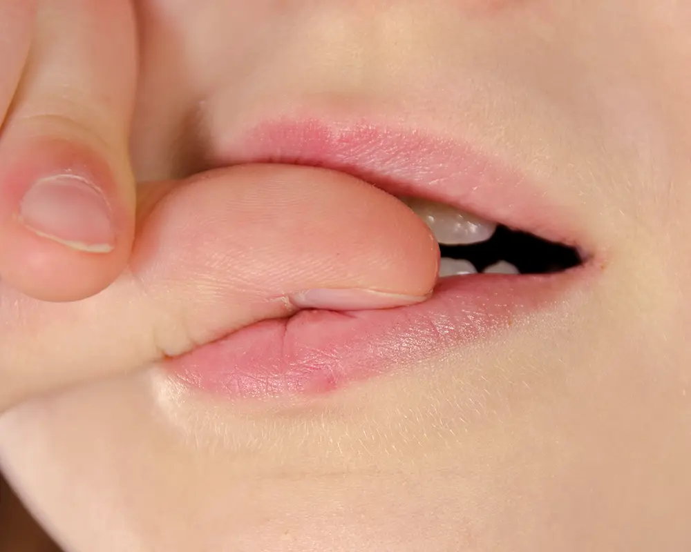 Nägelkauen Entwöhnung