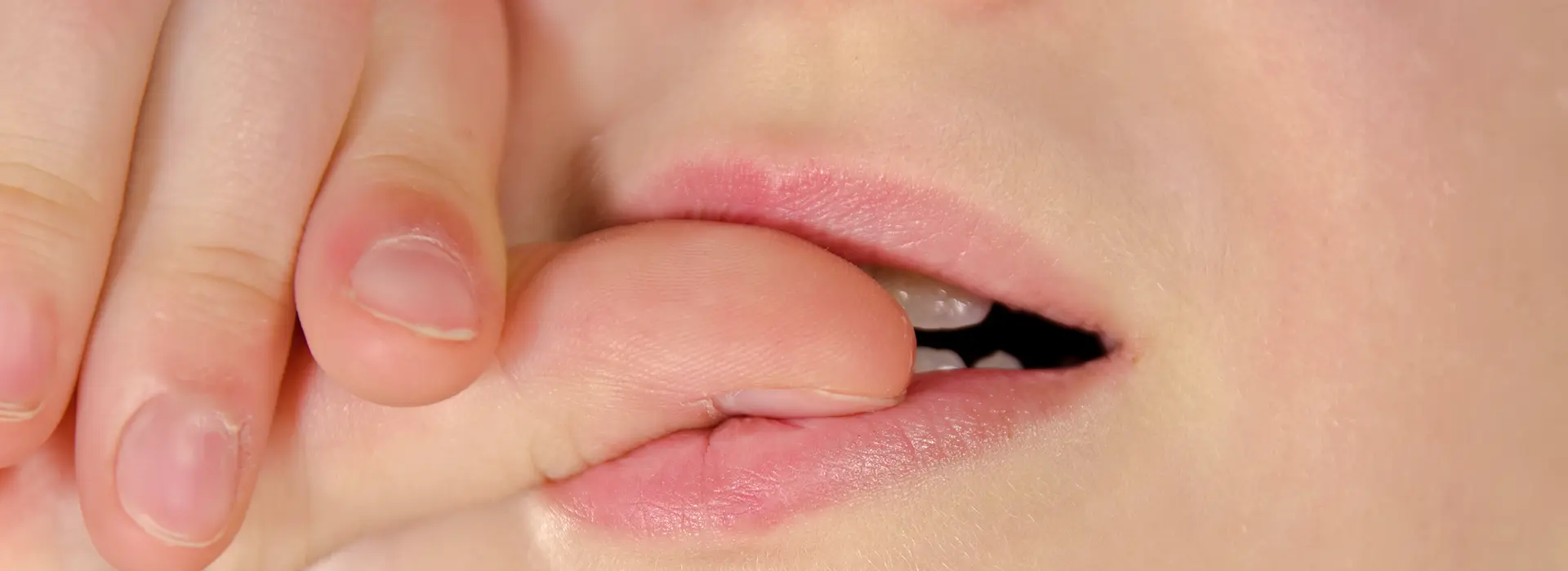 Nägelkauen Entwöhnung